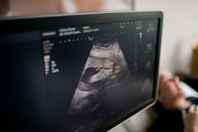 Brazil Birth Tourism Package Passport Service